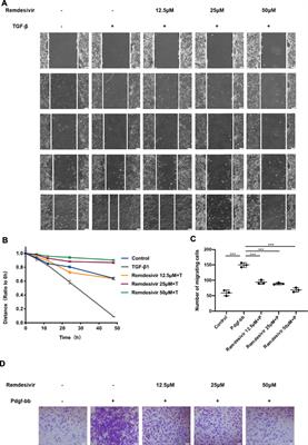 Protective Effect of Remdesivir Against Pulmonary Fibrosis in Mice